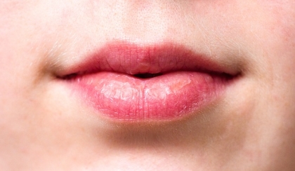 Piękne usta dzięki zabiegowi z kwasem hialuronowym